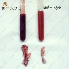 Biểu hiện của bệnh thiếu máu trên gà