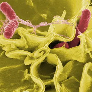 Cách tiệt trùng trứng mới giúp giảm mầm bệnh Salmonella.